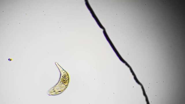 Golden ciliate swimming near algae under microscope, arched translucent body illuminated by contrast, visible cilia at anterior region, solitary specimen on slide undergoing observation, laboratory