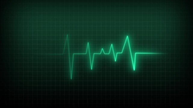 Heartbeat line animation with green neon pulse. Heartbeat line medical monitor on grid. Heartbeat line healthcare and medical technology graphic on black.