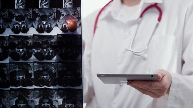 Tracking shot doctor reviewing patient x ray scans, MRI of back on tablet in clinic, white background.