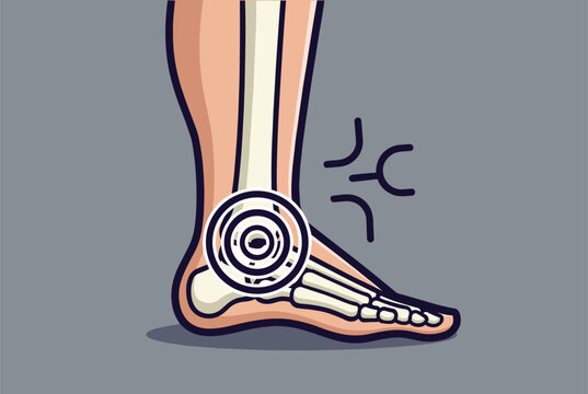 Skeletal illustration of the human ankle and foot with red concentric circles indicating localized joint pain or injury.
