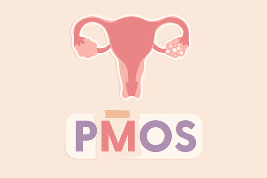 Minimalist flat vector design featuring the acronym PMOS with an anatomical diagram of the uterus and ovaries.