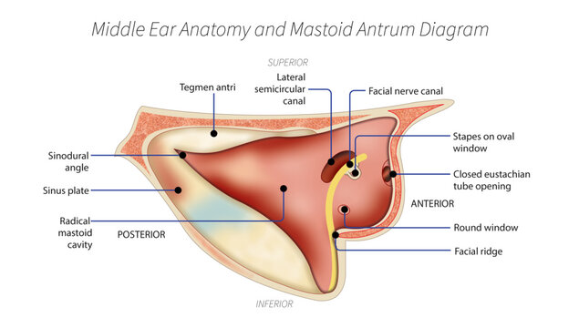 Middle Ear Anatomy and Mastoid Antrum Diagram
Detailed otology illustration showing middle ear anatomy, mastoid antrum, facial nerve canal, semicircular canal, oval window, and round window.