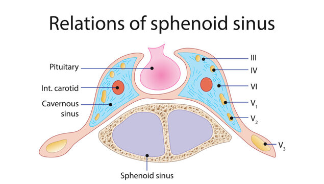 Relations of the Sphenoid Sinus
Cross-sectional anatomy illustration showing the sphenoid sinus in relation to the pituitary gland, cavernous sinus, internal carotid artery, and cranial nerves.