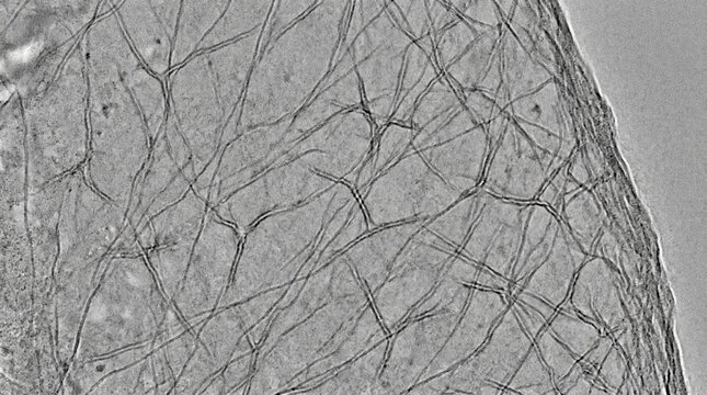 Cryo-ET Actin Branched Network Arp2/3 Complex in Lamellipodia