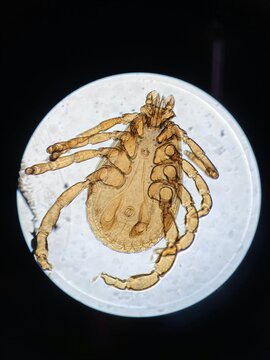 Microscopic view of a tick specimen on a slide, detailed anatomy of Ixodidae parasite under light microscope.