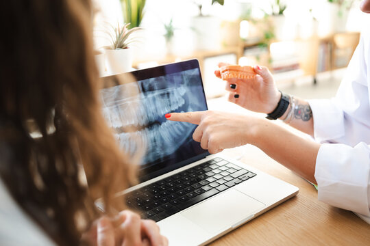A dentist shows a patient a dental x-ray on a laptop screen, holding a model of teeth for explanation.