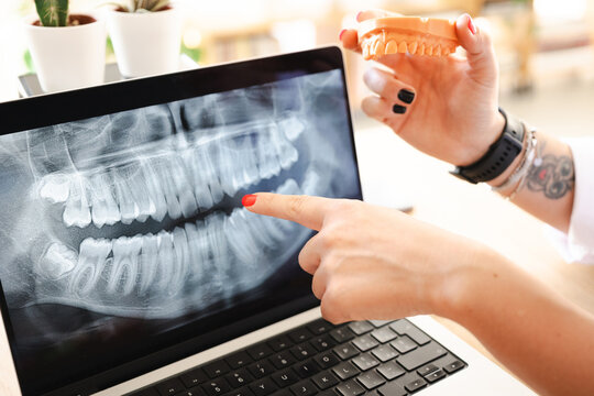 A dentist examines a dental x-ray on a laptop screen while holding a model of teeth, discussing treatment options with a patient.