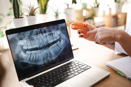 A dental professional examines a dental x-ray on a laptop screen while holding a model of teeth, demonstrating a modern approach to oral healthcare.