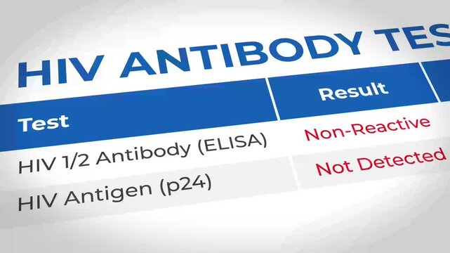 HIV Antibody Test Result Display with Laboratory Results and Data