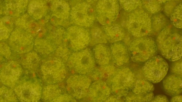 Euglena sp. palmelloid stage at 20x darkfield microscopy