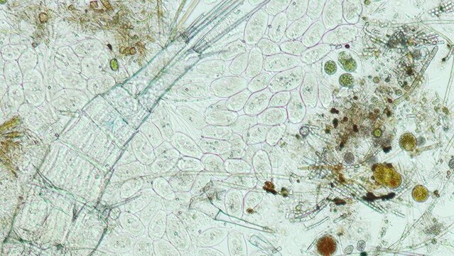 Peritrichia sp. ciliates at 10x brightfield microscopy