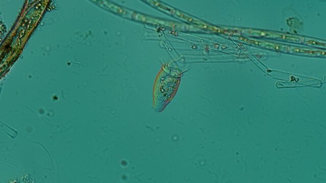 Peritrichia sp. ciliates at 20x DIC microscopy