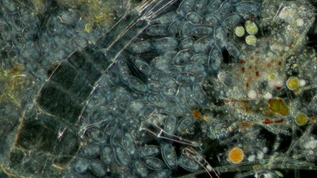 Peritrichia sp. ciliates at 20x darkfield microscopy