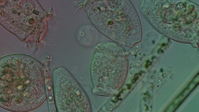Peritrichia sp. ciliates at 50x DIC microscopy