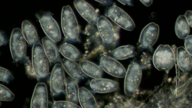 Peritrichia sp. ciliates at 20x darkfield microscopy