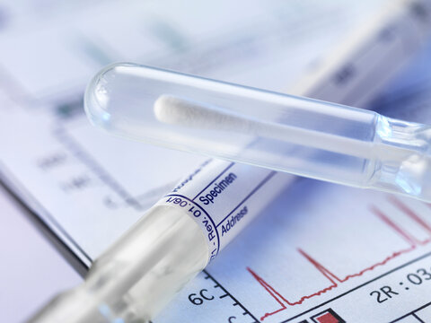 DNA sample swab inside test tube on medical document