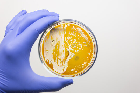 A scientist holds a Petri dish containing white bacteria on an orange nutrient medium. Analysis of actinobacteria growth on the Petri dish.