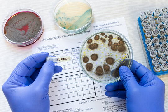 A scientist holds a petri dish containing dangerous bacterial clones and a test tube containing Escherichia coli bacteria against the backdrop of a laboratory protocol.
