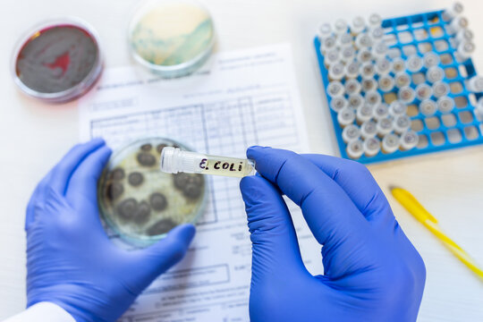 A doctor holds a small test tube with a strain of Escherichia coli against the background of a laboratory form, petri dishes, and a rack with test tubes.