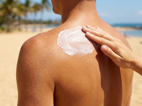 Primer plano de un hombre aplicando crema protectora solar en la espalda de su pareja en la playa durante el verano.