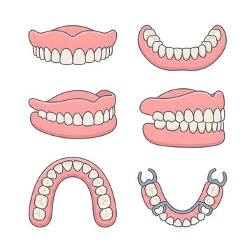 Comprehensive set of dental prosthetics including full and partial dentures for oral health.
