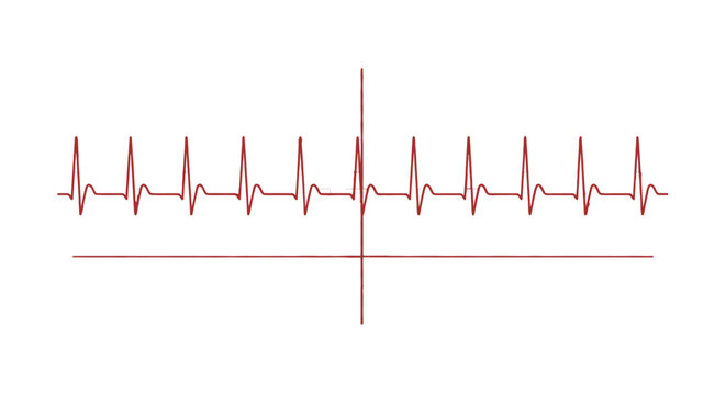electrocardiogram ecg or ekg showing an irregular heart rhythm and arrhythmia vital for cardiac health medical diagnosis.