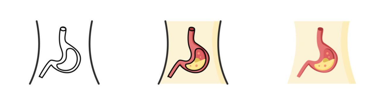 Set of Gastroesophageal Reflux Disease (GERD) on white background.