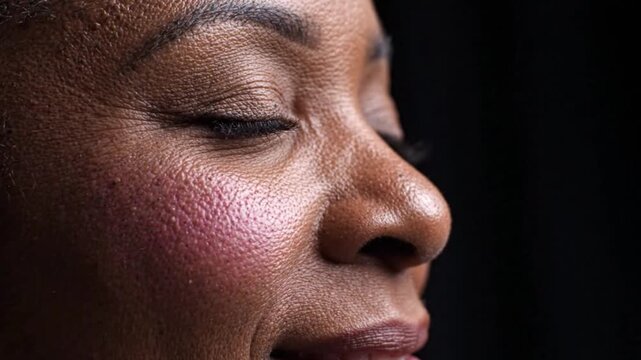 Close-up of woman's face with rosacea