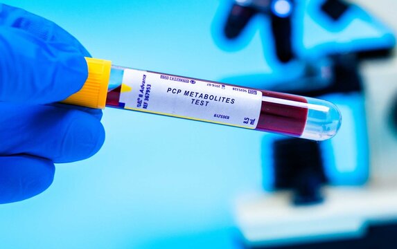 Detects metabolites of PCP, used to confirm the use of this