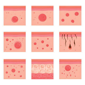 Skin Cells and Tissue Structure.