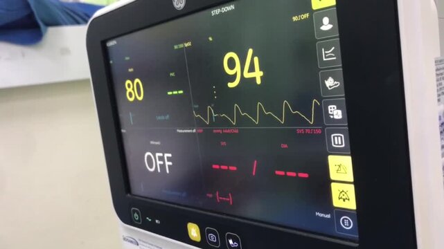 Vital Signs Monitor Display: A close-up shot of a medical monitor screen displaying vital signs, including heart rate and oxygen saturation levels, with a clear OFF status indicator.