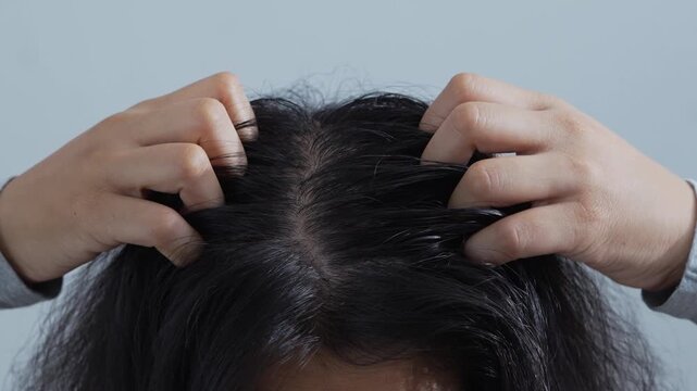 A woman has problems with hair and  itchy scalp, she has dandruff from allergic reactions to shampoos. and hair conditioner. 