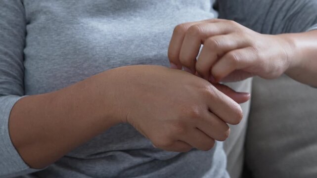 Dermatology, woman reaction from atopic, insect bites on her arm, hand in scratching itchy or rash of skin, treatment of beauty. Healthcare and medical concept.	