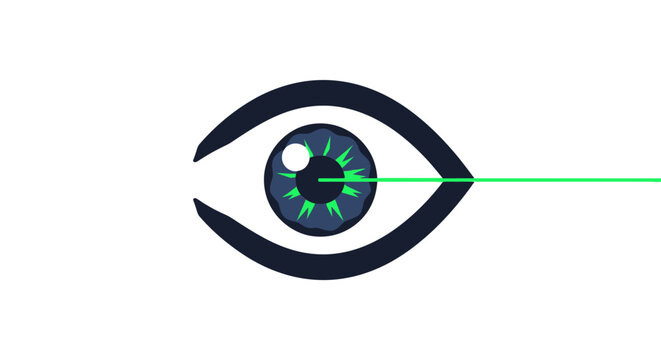 LASIK Laser Eye Surgery Concept Vector Illustration. Medical Ophthalmology Procedure for Vision Correction, Myopia Treatment, and Eye Care Technology.