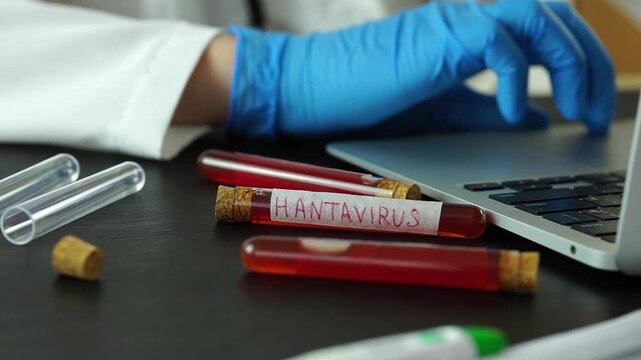 hantavirus blood test tube medical worker putting electronic thermometer on desk laboratory analysis research concept of medicine, healthcare, science