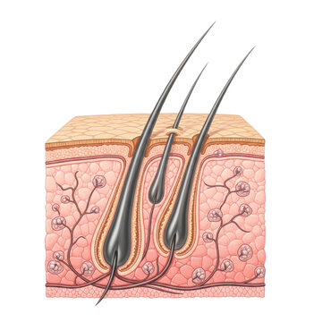 Hair follicle extraction needles insertion isolated on a transparent background