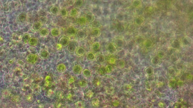 The simplest unicellular green algae and the moving unicellular green Euglena.