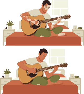 Young Man with Vitiligo Skin Condition Playing Acoustic Guitar on Bed in Bedroom for Diversity Inclusion and Mental Wellness Concept Designs