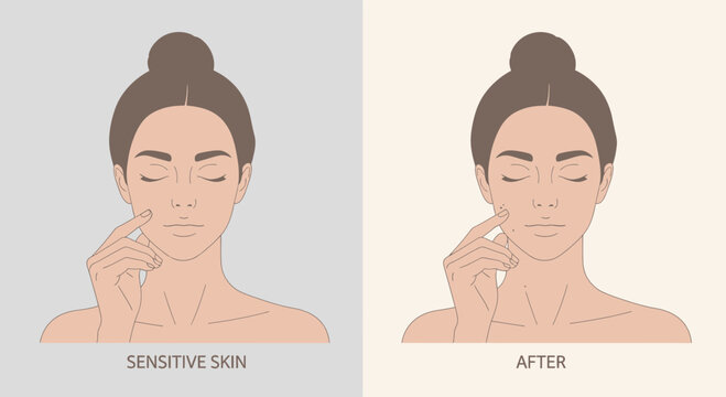 Skincare before and after concept. Facial treatment.