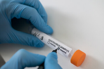 Obraz premium Close-up of a laboratory technician using a marker to check the negative result box on a hantavirus sample tube.