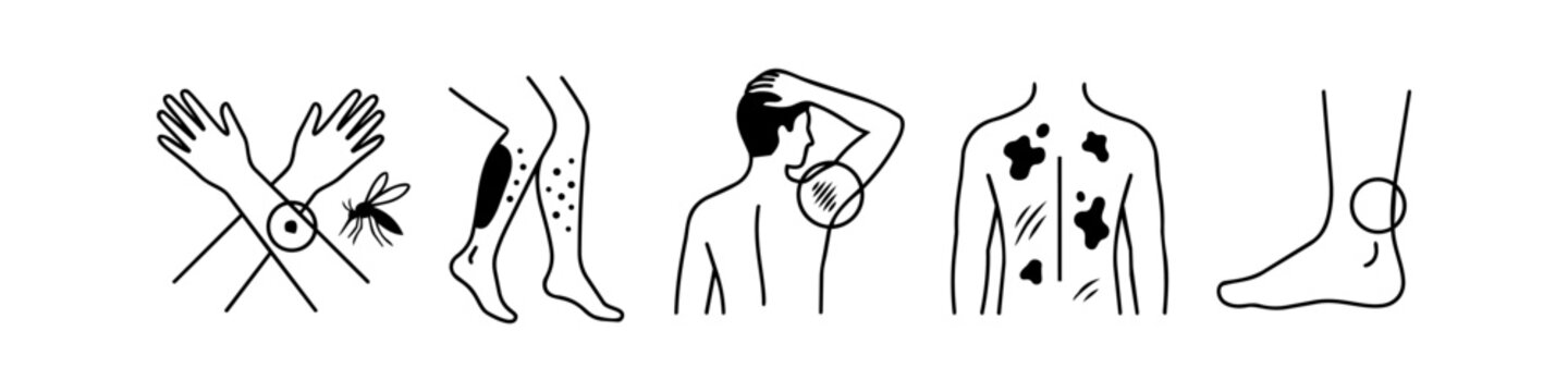 Clean line art icons depicting various dermatological and medical conditions, including insect bites, skin rashes, melanoma, and joint pain on different body parts.