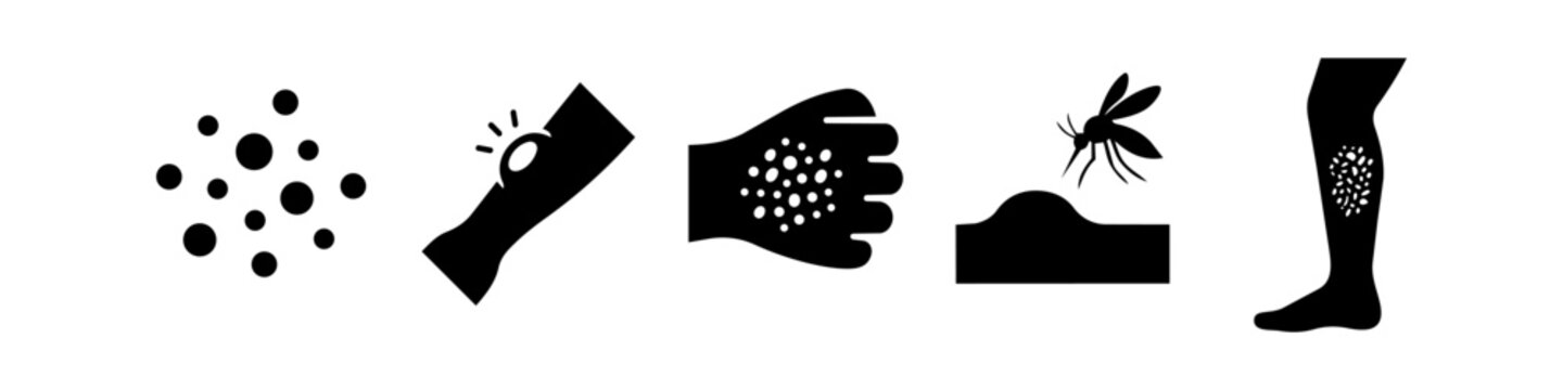 Set of black silhouette icons representing skin conditions like rashes, mosquito bites, welts, and allergies on the hand and leg. Ideal for medical, healthcare, and dermatology topics.