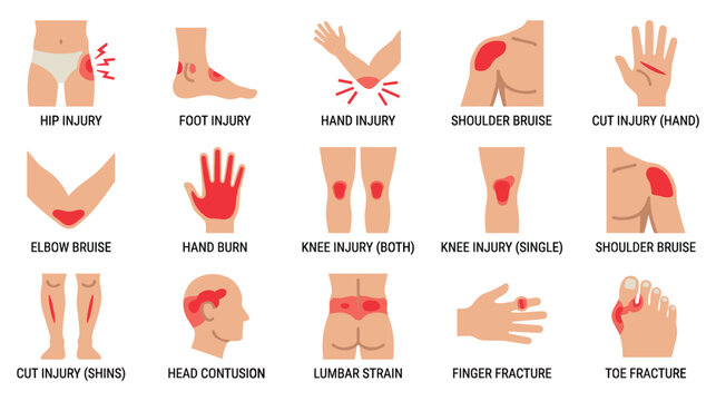 Human body injury diagram showing various physical trauma points.