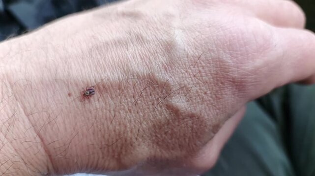 A tick crawls on a person's hand

