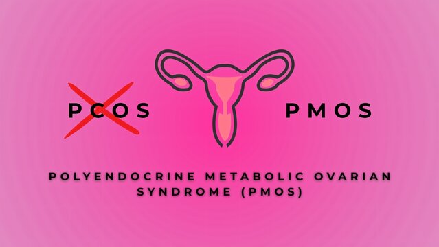PCOS is now officially PMOS. Discover why global health experts renamed polycystic ovary syndrome to polyendocrine metabolic ovarian syndrome to improve diagnosis and whole-body care.