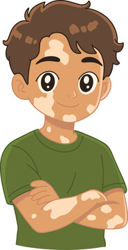 Vitiligo Boy Confident Standing Pose
