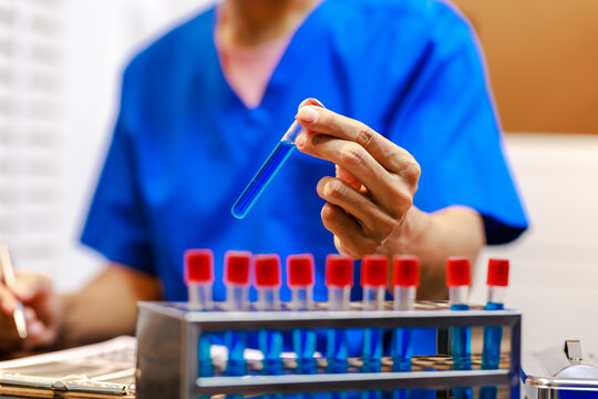 Close-up of healthcare worker in blue scrubs holding test tube above rack of blood sample vials with red caps in clinic or lab setting, concept of medical testing and diagnostics.