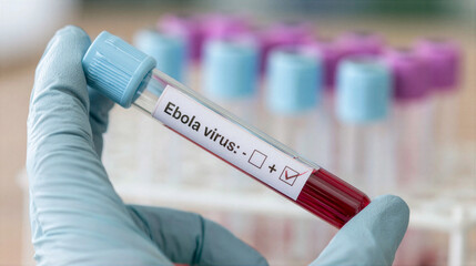 Obraz premium Ebola virus blood sample in gloved hand, medical laboratory test vial