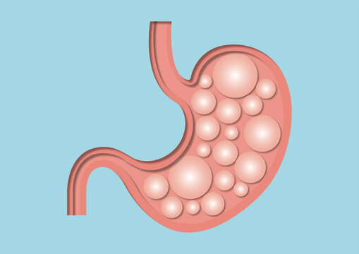 Stomach acid, conceptual illustration