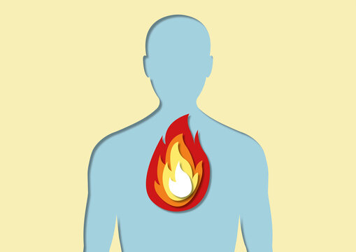 Heartburn, conceptual illustration